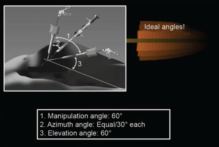 Ideal angles