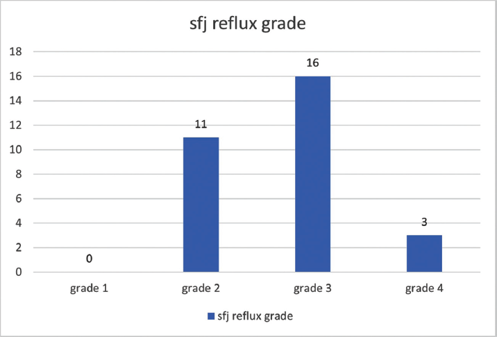 Distribution of SFJ reflux grades across patients. SFJ, saphenofemoral junction.