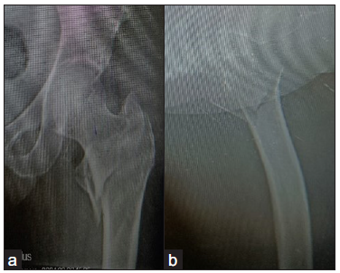 AP and lateral views.